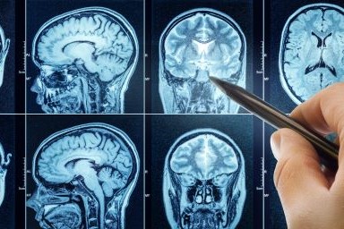 Subtle Injury. Examples Subtle Brain Injury: Understanding Symptoms and Treatment Approaches ...